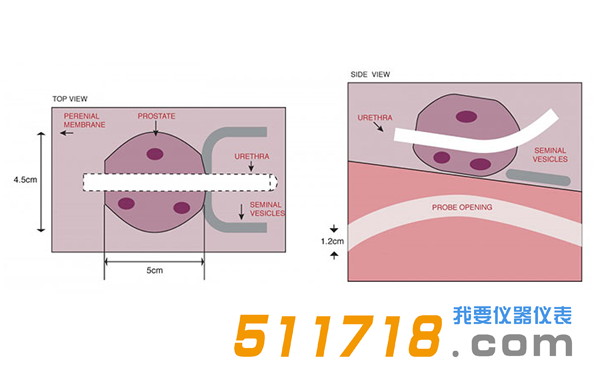 美國(guó)CIRS 053S 053L 053L-EF前列腺M(fèi)RI測(cè)試體模2.png